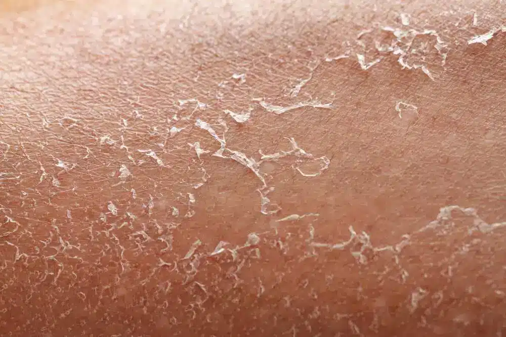 piel seca con picor hidratación mujer madura