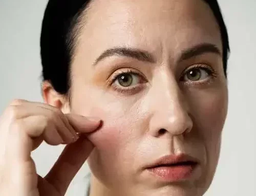 Piel madura con tendencia grasa: por qué ocurre y cómo cuidarla