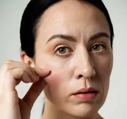 piel madura con grasa poros visibles rostro